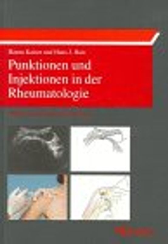 Punktionen und Injektionen in der Rheumatologie