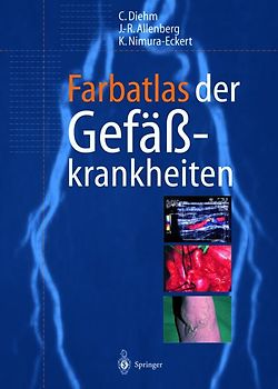 Farbatlas der Gefässkrankheiten