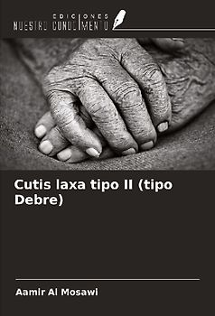 Cutis laxa tipo II (tipo Debre)