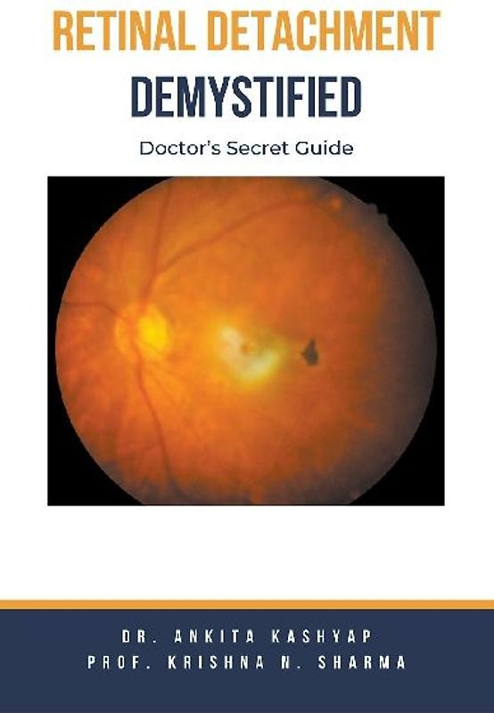 Retinal Detachment Demystified