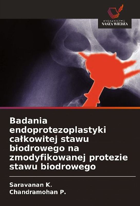 Badania endoprotezoplastyki ca¿kowitej stawu biodrowego na zmodyfikowanej protezie stawu biodrowego