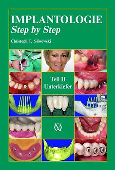 Implantologie Step by Step