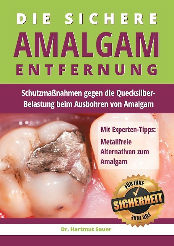 Die sichere Amalgam-Entfernung