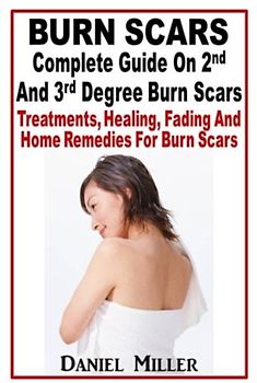 Burn Scars : Complete Guide On 2nd And 3rd Degree Burn Scars: Treatments, Healing, Fading And Home Remedies For Burn Scars