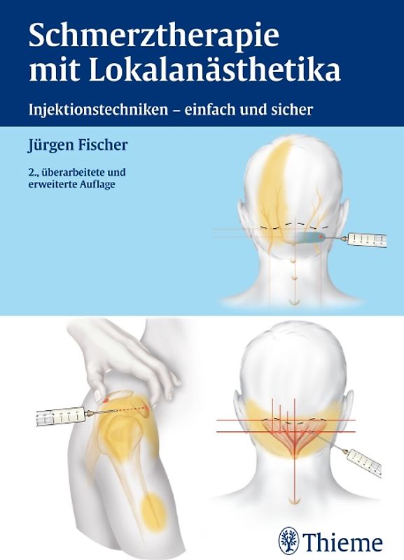 Schmerztherapie mit Lokalanästhetika