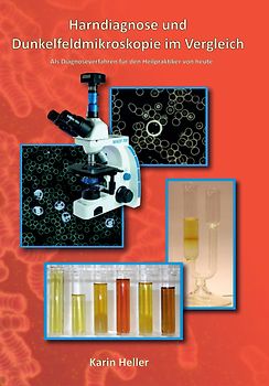 Harndiagnose und Dunkelfeldmikroskopie im Vergleich
