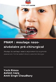 PNAM : moulage naso-alvéolaire pré-chirurgical