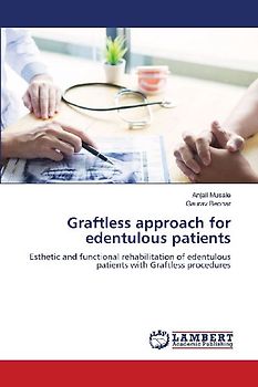 Graftless approach for edentulous patients
