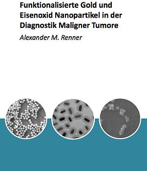 Funktionalisierte Gold und Eisenoxid Nanopartikel in der Diagnostik Maligner Tumore