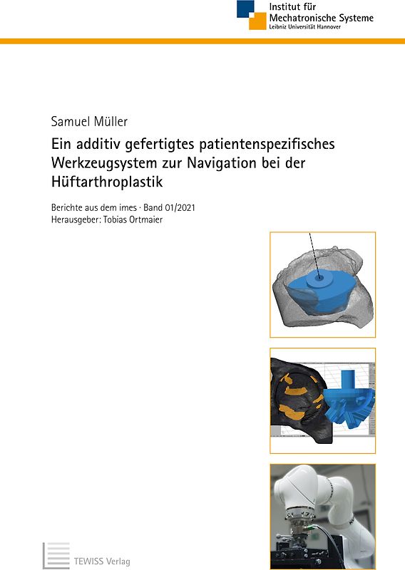 Ein additiv gefertigtes patientenspezifisches Werkzeugsystem zur Navigation bei der Hüftarthroplastik