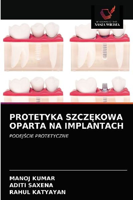 PROTETYKA SZCZ¿KOWA OPARTA NA IMPLANTACH