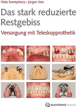 Das stark reduzierte Restgebiss