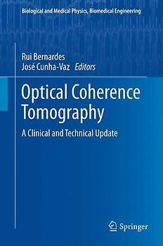 Optical Coherence Tomography