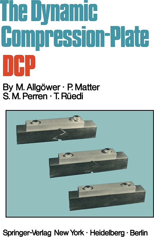 The Dynamic Compression Plate DCP