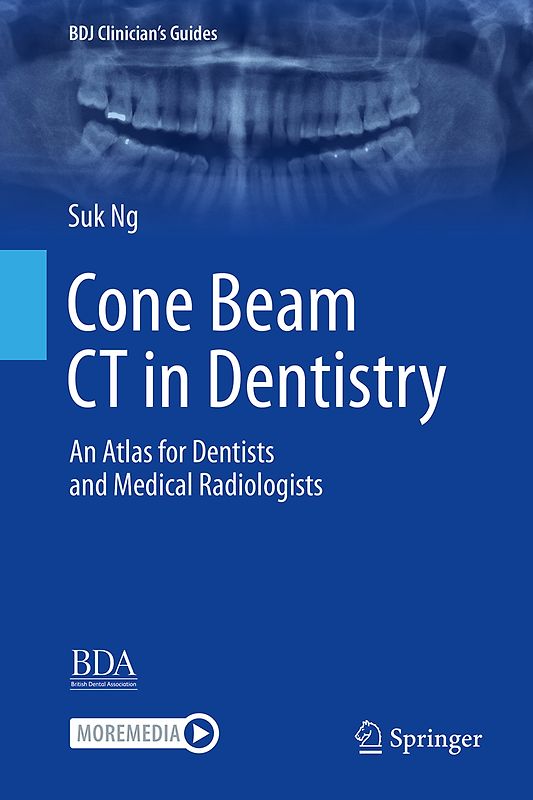Cone Beam CT in Dentistry