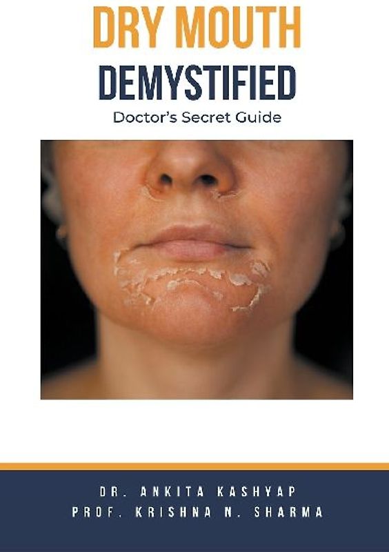 Dry mouth Demystified