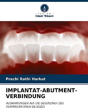 IMPLANTAT-ABUTMENT-VERBINDUNG