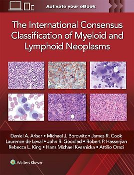 The International Consensus Classification of Myeloid and Lymphoid Neoplasms