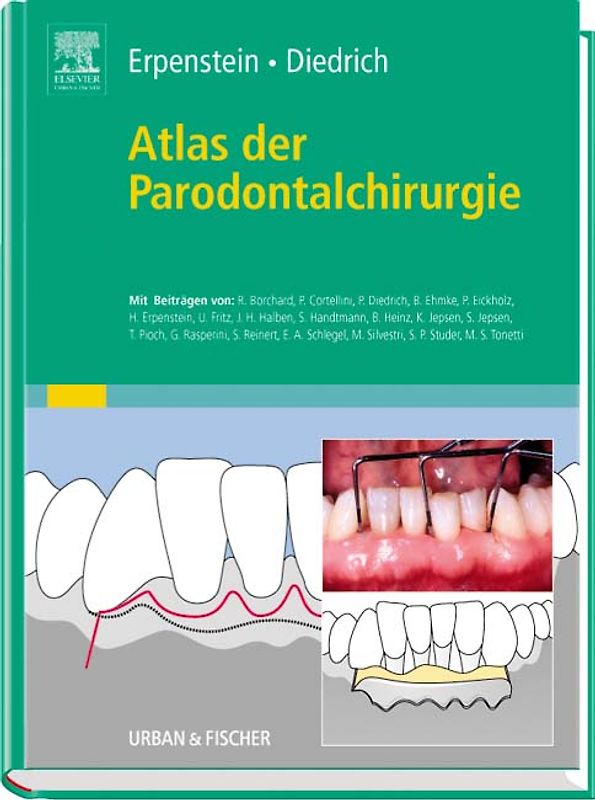 Atlas der Parodontalchirurgie