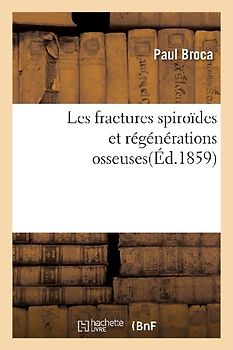 Les Fractures Spiroïdes Et Régénérations Osseuses