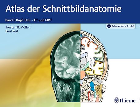 Atlas der Schnittbildanatomie