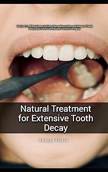 Natural Treatment for Extensive Tooth Decay: Cavity 101, What Causes it, Home Remedies to Stop and Remove Tooth Decay and Never Get Another Cavity Ever Again