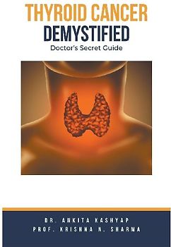 Thyroid Cancer Demystified Doctors Secret Guide