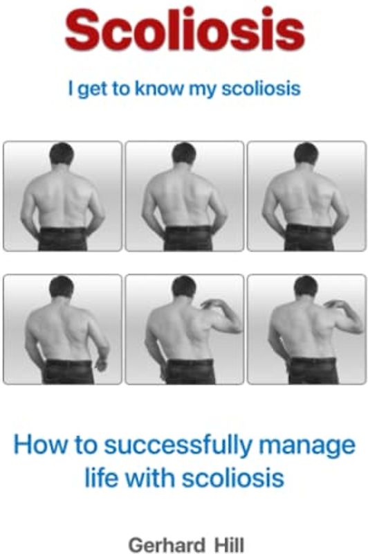 Scoliosis: I'm getting to know my scoliosis