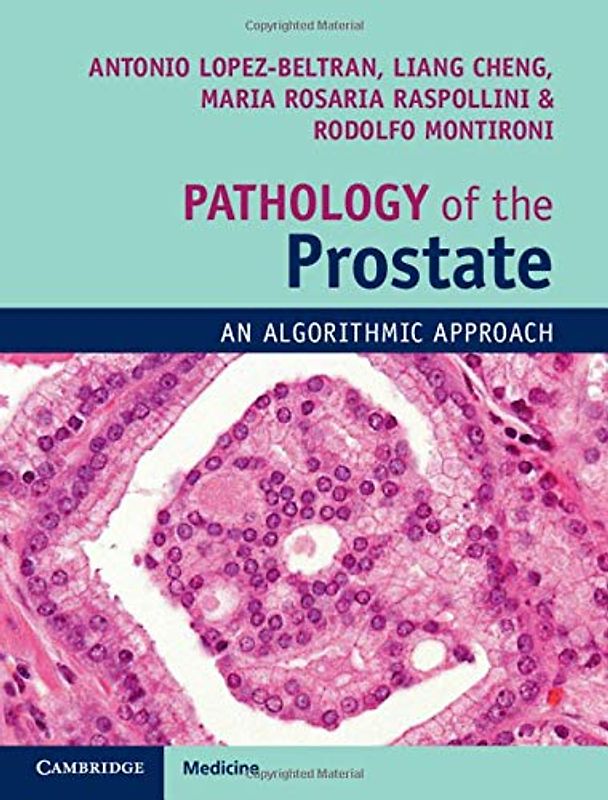 Pathology of the Prostate: An Algorithmic Approach