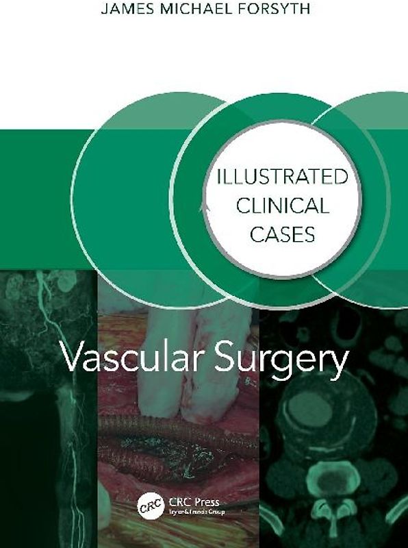 Vascular Surgery