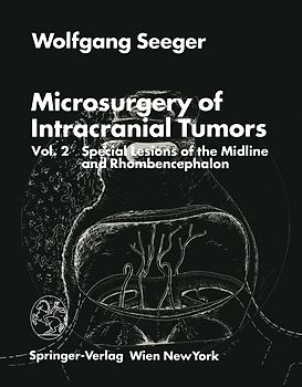 Microsurgery of Intracranial Tumors