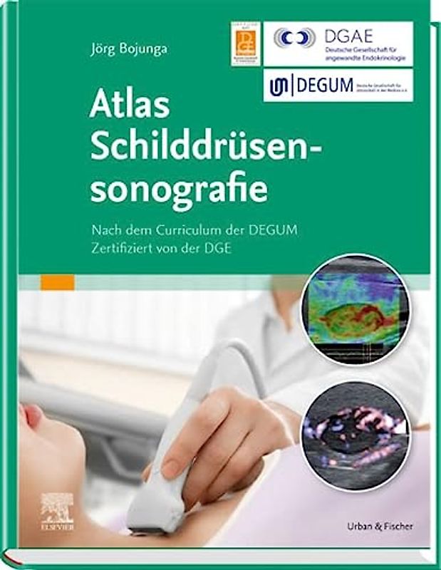 Atlas Schilddrüsensonografie