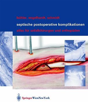 Septische postoperative Komplikationen