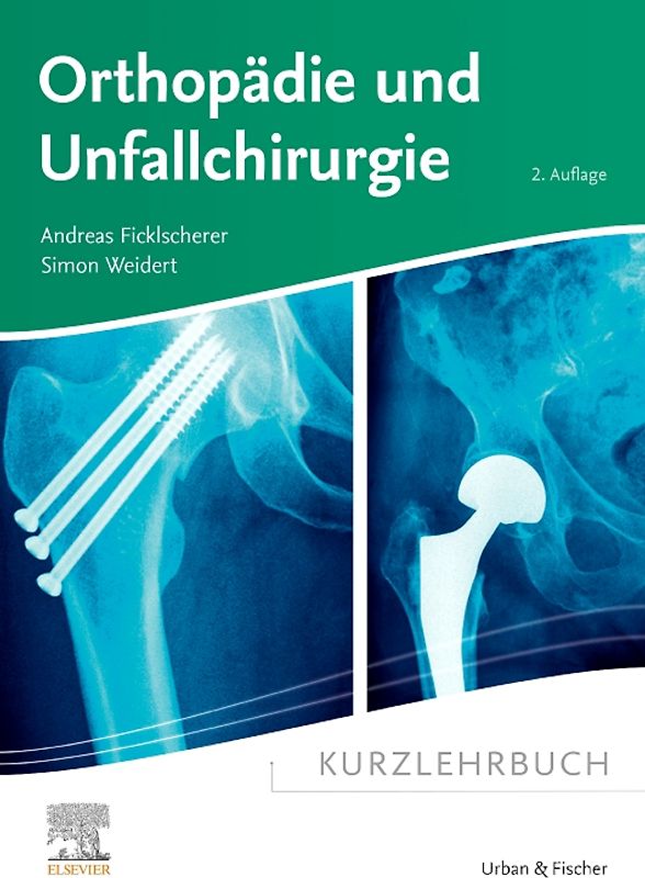 Kurzlehrbuch Orthopädie und Unfallchirurgie
