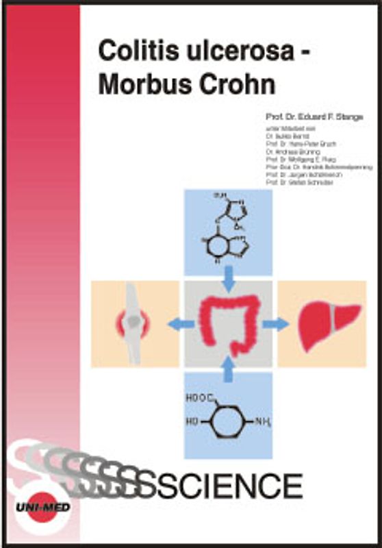 Colitis ulcerosa - Morbus Crohn