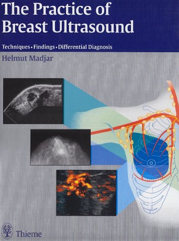 The Practice of Breast Ultrasound