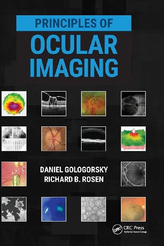 Principles of Ocular Imaging