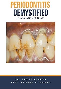 Periodontitis Demystified