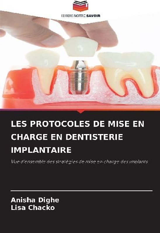 LES PROTOCOLES DE MISE EN CHARGE EN DENTISTERIE IMPLANTAIRE