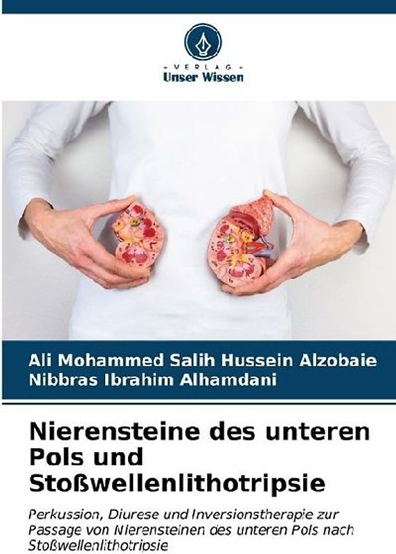 Nierensteine des unteren Pols und Stoßwellenlithotripsie