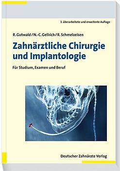 Zahnärztliche Chirurgie und Implantologie