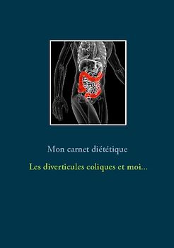 Mon carnet diététique : les diverticules coliques et moi...