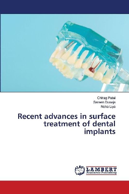 Recent advances in surface treatment of dental implants