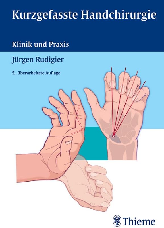 Kurzgefasste Handchirurgie