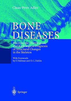 Bone Diseases