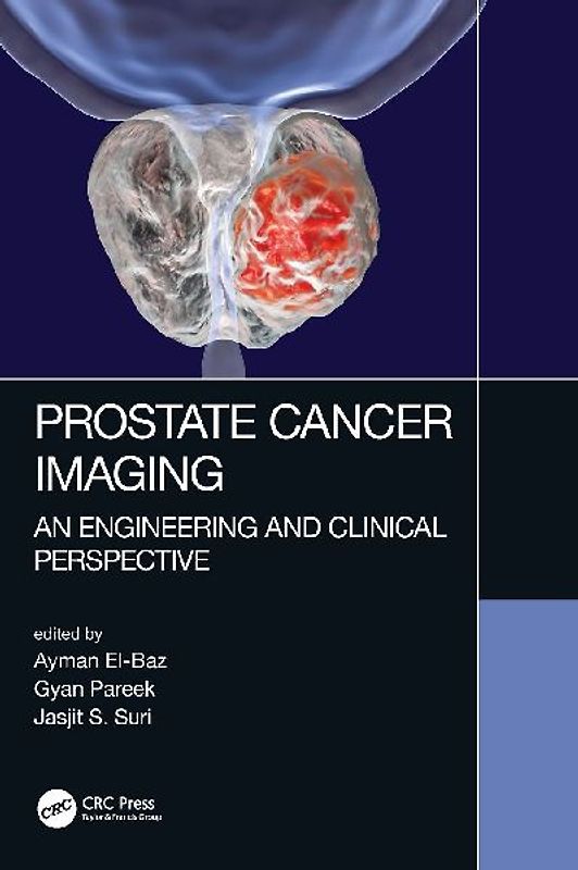 Prostate Cancer Imaging