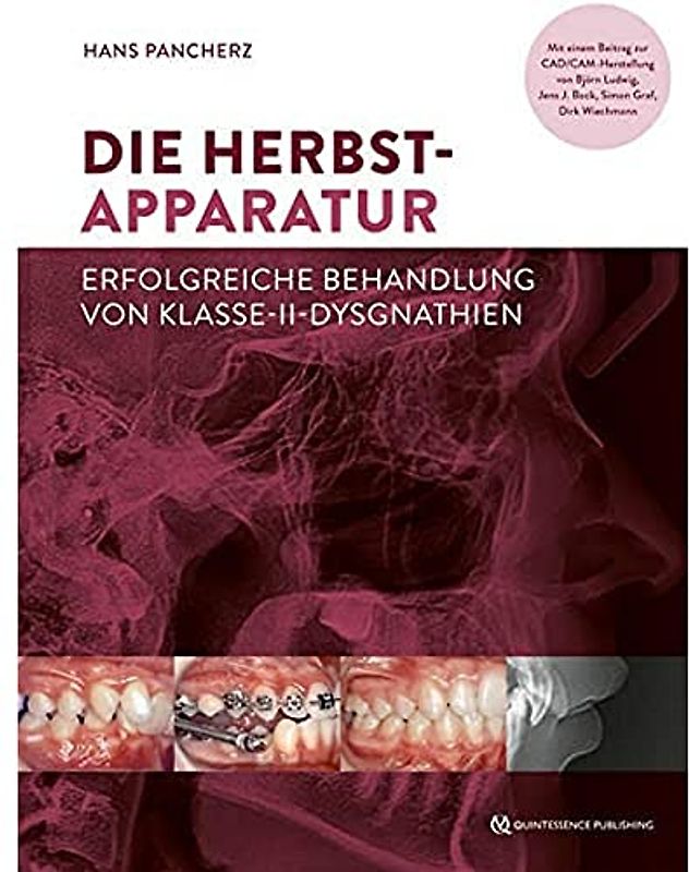 Die Herbst-Apparatur