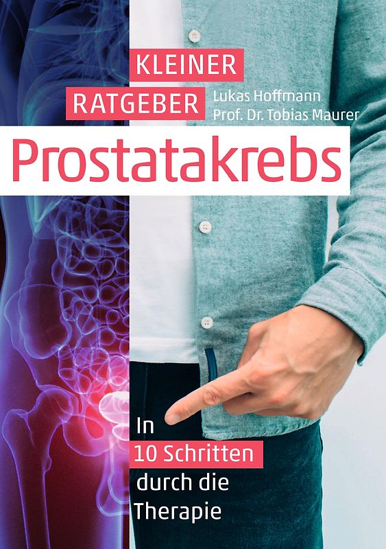Kleiner Ratgeber Prostatakrebs