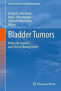 Bladder Tumors:
