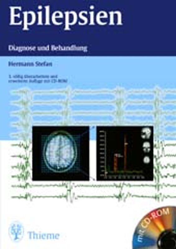 Epilepsien. Diagnose und Behandlung